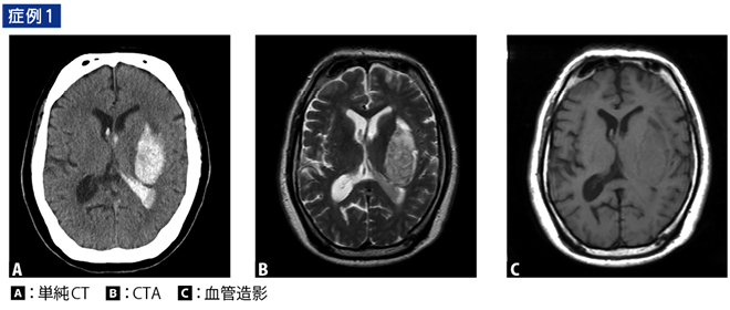 頭部CT・MRIの撮像・読影マスター – 日本医事新報社